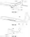 Fig. 32 - SYSTEMS, DEVICES, AND METHODS FOR THE RETRIEVAL OF AN IMPLANT IN THE PROSTATIC URETHRA