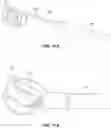 Fig. 33 - SYSTEMS, DEVICES, AND METHODS FOR THE RETRIEVAL OF AN IMPLANT IN THE PROSTATIC URETHRA