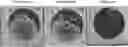 Fig. 01 - METHODS AND MATERIALS FOR MODIFYING CORNEAL SHAPE