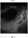 Fig. 02 - METHODS AND MATERIALS FOR MODIFYING CORNEAL SHAPE