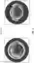 Fig. 03 - METHODS AND MATERIALS FOR MODIFYING CORNEAL SHAPE