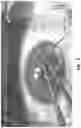 Fig. 08 - METHODS AND MATERIALS FOR MODIFYING CORNEAL SHAPE