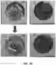 Fig. 11 - METHODS AND MATERIALS FOR MODIFYING CORNEAL SHAPE
