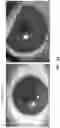 Fig. 17 - METHODS AND MATERIALS FOR MODIFYING CORNEAL SHAPE