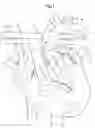 Fig. 02 - Artificial valve