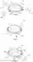 Fig. 11 - Artificial valve