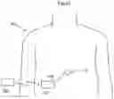 Fig. 16 - Artificial valve