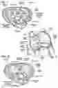 Fig. 03 - COLLAPSIBLE-EXPANDABLE HEART VALVES