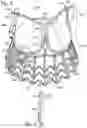 Fig. 04 - COLLAPSIBLE-EXPANDABLE HEART VALVES
