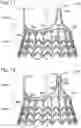 Fig. 09 - COLLAPSIBLE-EXPANDABLE HEART VALVES