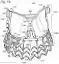 Fig. 10 - COLLAPSIBLE-EXPANDABLE HEART VALVES