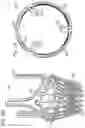 Fig. 14 - COLLAPSIBLE-EXPANDABLE HEART VALVES