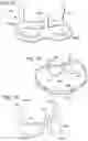 Fig. 17 - COLLAPSIBLE-EXPANDABLE HEART VALVES