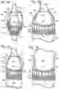 Fig. 19 - COLLAPSIBLE-EXPANDABLE HEART VALVES
