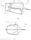 Fig. 12 - Heart valve therapeutic device