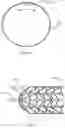 Fig. 24 - Heart valve therapeutic device
