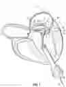 Fig. 02 - REPLACEMENT HEART VALVE SYSTEMS AND METHODS