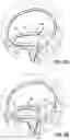 Fig. 03 - REPLACEMENT HEART VALVE SYSTEMS AND METHODS