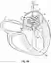 Fig. 08 - REPLACEMENT HEART VALVE SYSTEMS AND METHODS