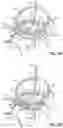 Fig. 10 - REPLACEMENT HEART VALVE SYSTEMS AND METHODS
