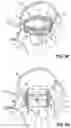 Fig. 11 - REPLACEMENT HEART VALVE SYSTEMS AND METHODS