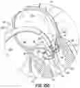 Fig. 20 - REPLACEMENT HEART VALVE SYSTEMS AND METHODS