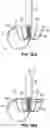 Fig. 23 - REPLACEMENT HEART VALVE SYSTEMS AND METHODS