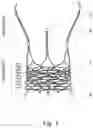 Fig. 02 - STENT OF AORTIC VALVE