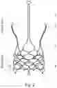 Fig. 03 - STENT OF AORTIC VALVE