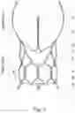 Fig. 04 - STENT OF AORTIC VALVE