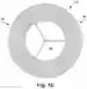 Fig. 04 - APPARATUS AND METHOD FOR REPLACING A DISEASED CARDIAC VALVE