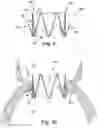 Fig. 12 - APPARATUS AND METHOD FOR REPLACING A DISEASED CARDIAC VALVE