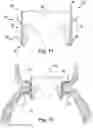 Fig. 13 - APPARATUS AND METHOD FOR REPLACING A DISEASED CARDIAC VALVE