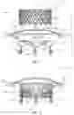 Fig. 05 - MITRAL VALVE PROSTHESIS IMPLANTATION