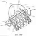 Fig. 09 - MITRAL VALVE PROSTHESIS IMPLANTATION