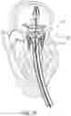 Fig. 25 - MITRAL VALVE PROSTHESIS IMPLANTATION