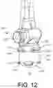 Fig. 11 - Pump bulb with control features