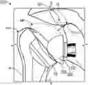 Fig. 01 - CONVERTIBLE ORTHOPAEDIC IMPLANT SYSTEMS AND METHODS