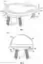 Fig. 02 - CONVERTIBLE ORTHOPAEDIC IMPLANT SYSTEMS AND METHODS