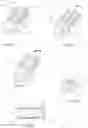Fig. 13 - INTERBODY CAGE AND METHOD OF INSERTION