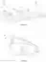 Fig. 08 - Expandable lordosis intervertebral implants