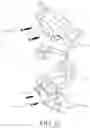 Fig. 22 - Spinal Prothesis