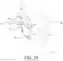 Fig. 23 - Spinal Prothesis