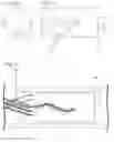 Fig. 04 - Implant insertion system