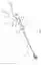 Fig. 02 - Surgical instrument and method