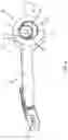 Fig. 05 - Surgical instrument and method