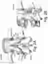 Fig. 03 - DEVICES AND METHODS FOR SPINAL IMPLANTATION