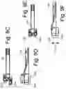 Fig. 13 - DEVICES AND METHODS FOR SPINAL IMPLANTATION