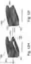 Fig. 18 - DEVICES AND METHODS FOR SPINAL IMPLANTATION