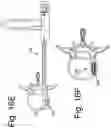 Fig. 24 - DEVICES AND METHODS FOR SPINAL IMPLANTATION